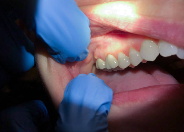 Best Emergency Cosmetic Dentistry (e.g., broken veneers) in Brownsville, TN